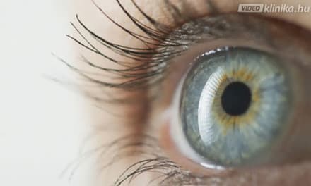 ha a látás plusz mit jelent hogyan lehet megtanulni tesztelni a látását