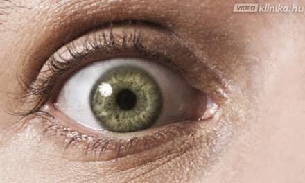A homályos látás okai • cellplast.hu, Hirtelen látásvesztés mindkét szemben