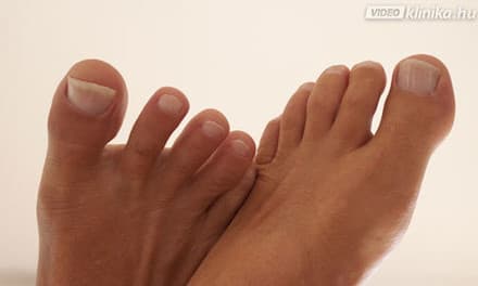 A lábszárfekély fajtái és tünetei