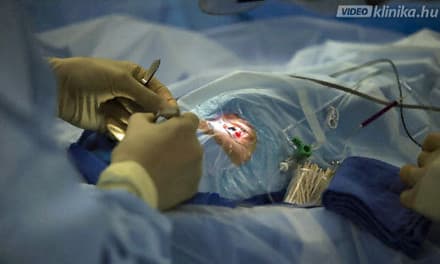 Hogyan változik a szürkehályog műtét utáni látás?