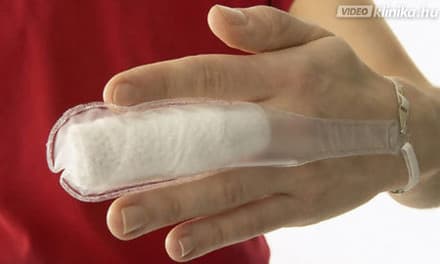 pattanó ujj műtét utáni torna milyen injekciókat adnak a vállízület fájdalmaihoz