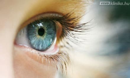 a látásélesség normája felnőtteknél látás 45 után