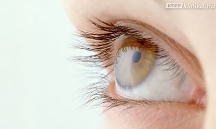 hologram a látáshoz hyperopia asztigmatizmus felnőtteknél