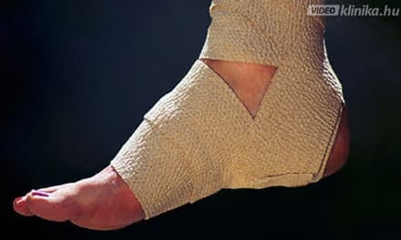 Széles bokaszalag - Az ínszalagszakadás tünetei és kezelése, A boka inak károsodása