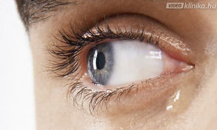 Könnyezik, viszket, fáj: milyen betegségeket jelez szemünk?