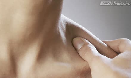 hogyan lehet kezelni a térdszalagok rohamait fiatal térd artrózisa