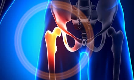 csípőízület hogyan lehet enyhíteni az akut fájdalmat szegycsont clavicularis ízület deformáló artrosis